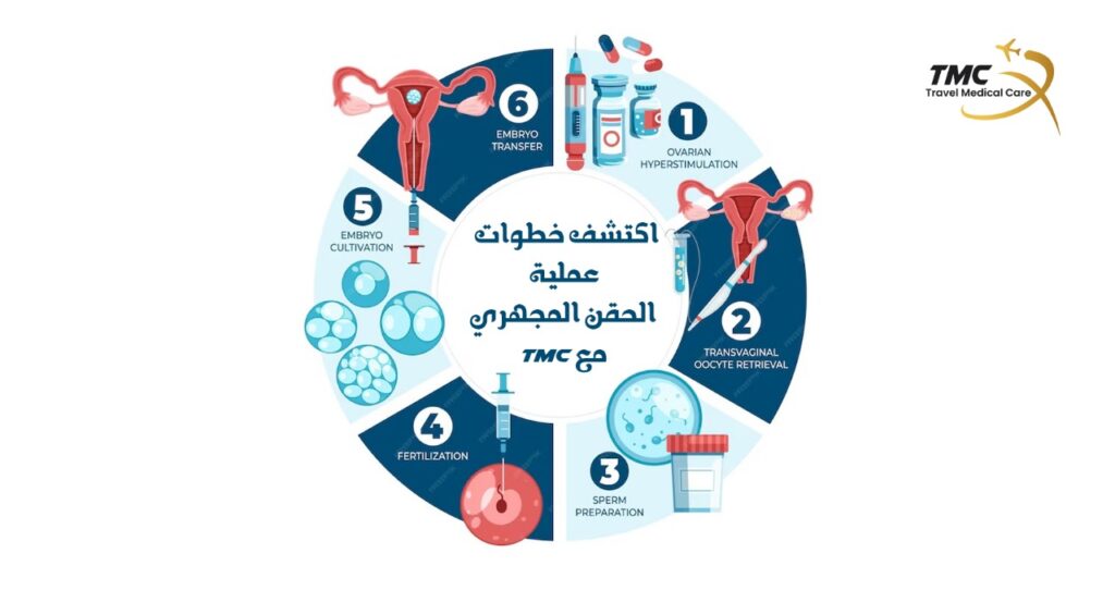 عملية الحقن المجهري